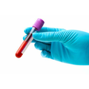 Analisi del sangue